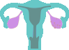 ovarian_cancer