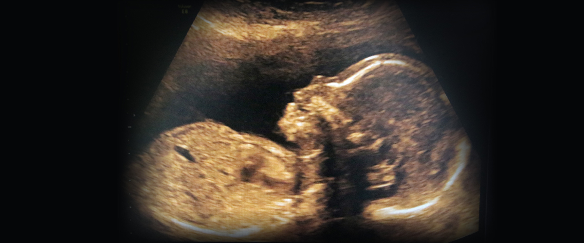 21 weeks pregnant ultrasound face
