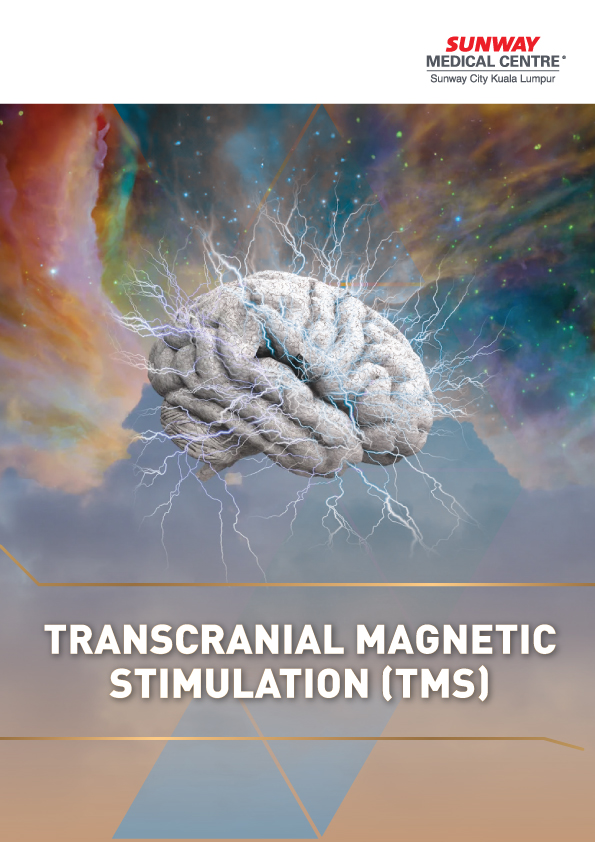 经颅磁刺激 (TMS)