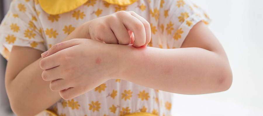 Hand, Foot, and Mouth Disease (HMFD): Symptoms and Treatment