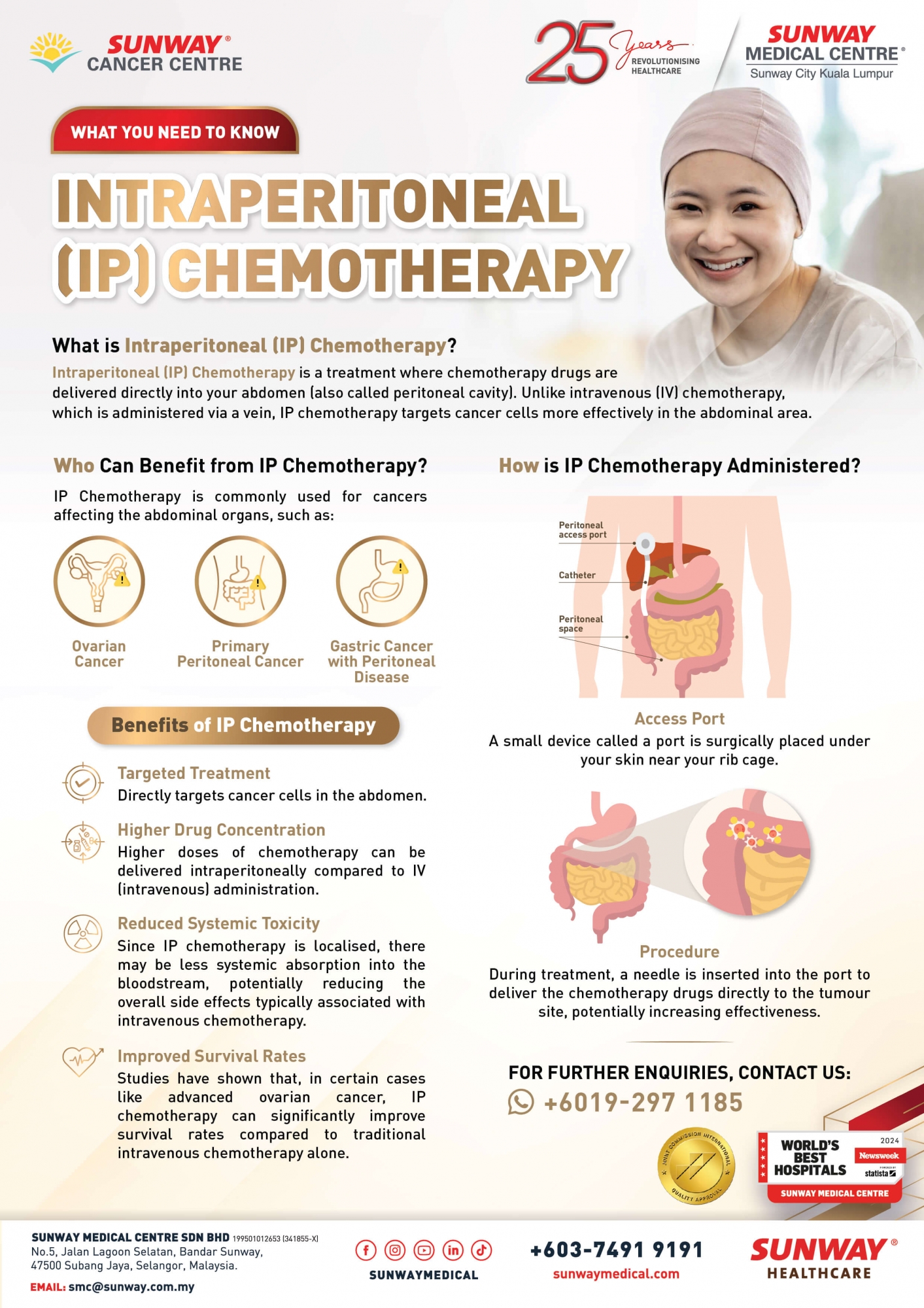 Intraperitoneal (IP) Chemotherapy